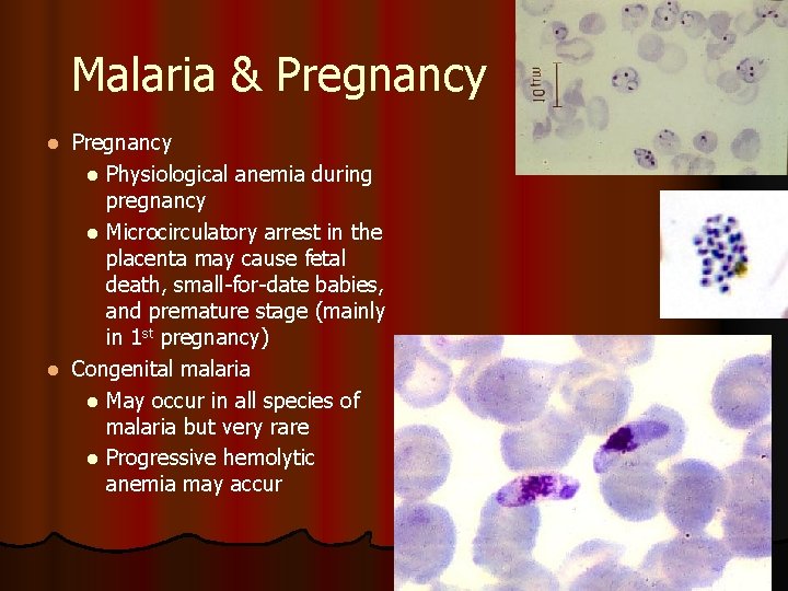 Malaria & Pregnancy l Physiological anemia during pregnancy l Microcirculatory arrest in the placenta
