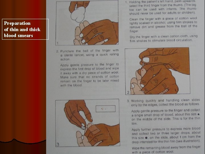 Preparation of thin and thick blood smears 