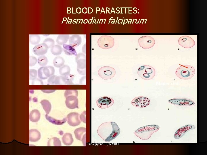 BLOOD PARASITES: Plasmodium falciparum Mauer cleft Supargiyono 13/07/2011 