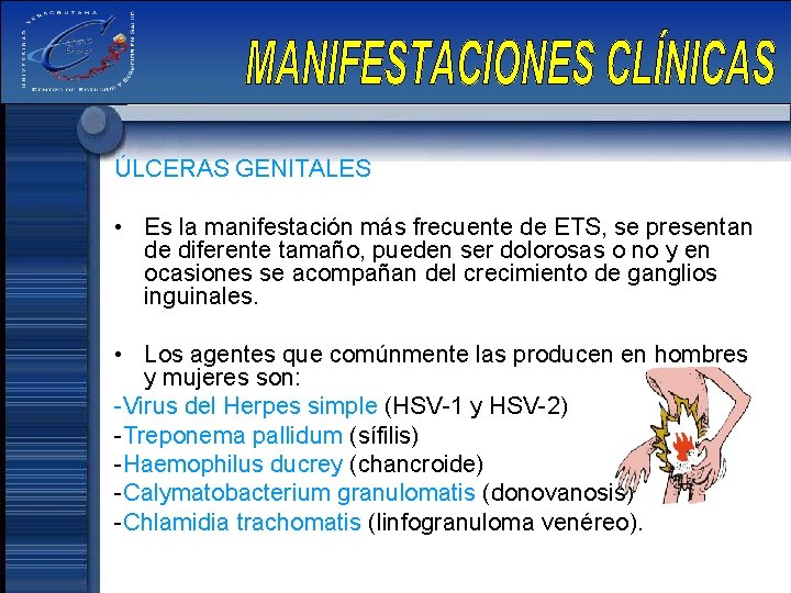 ÚLCERAS GENITALES • Es la manifestación más frecuente de ETS, se presentan de diferente