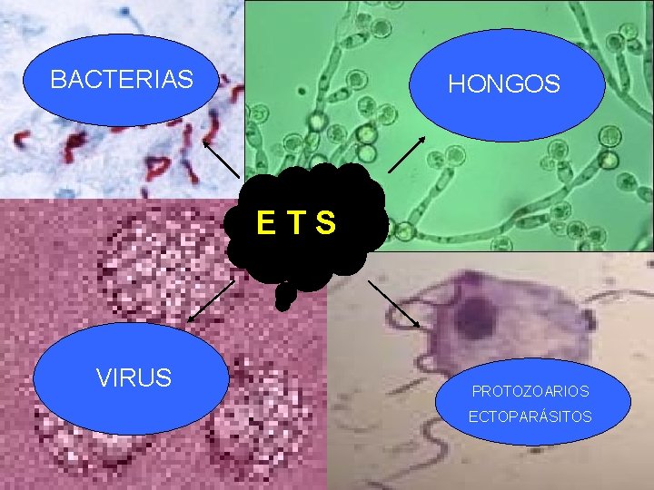 BACTERIAS HONGOS ETS VIRUS PROTOZOARIOS ECTOPARÁSITOS 