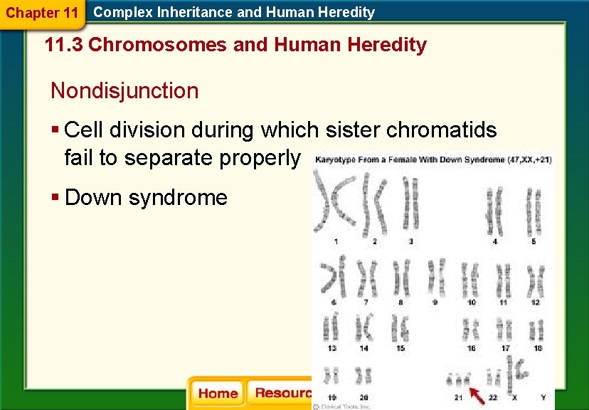 Chapter 11 Complex Inheritance and Human Heredity 11. 3 Chromosomes and Human Heredity Nondisjunction