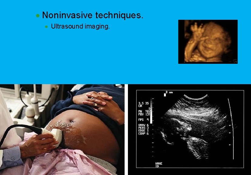 · Noninvasive techniques. · Ultrasound imaging. 