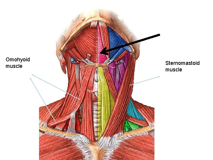 Omohyoid muscle Sternomastoid muscle 