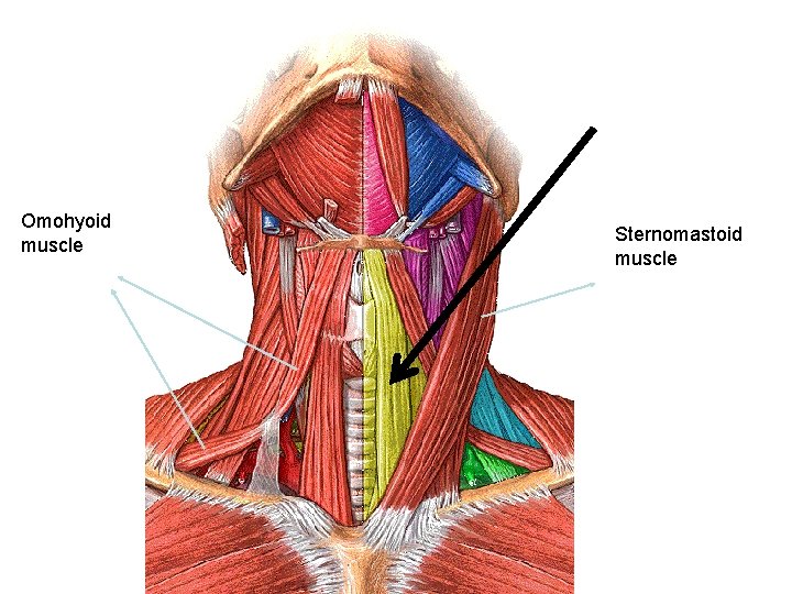 Omohyoid muscle Sternomastoid muscle 