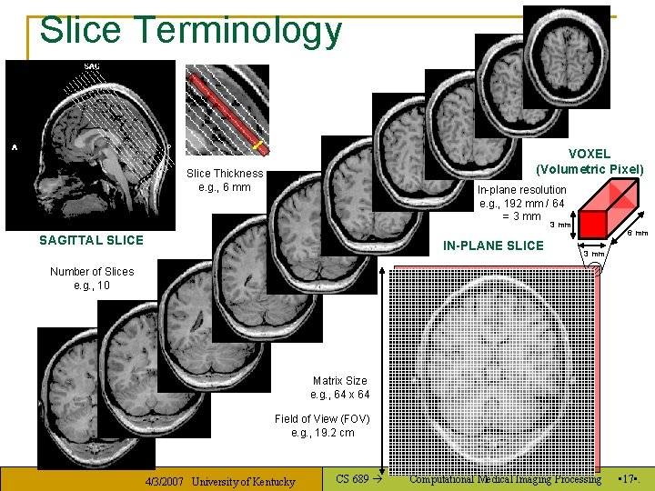 Slice Terminology VOXEL (Volumetric Pixel) Slice Thickness e. g. , 6 mm In-plane resolution