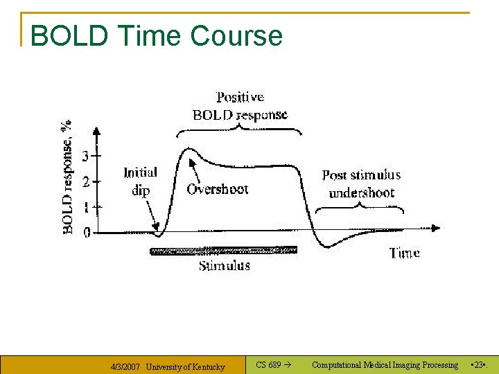 BOLD Time Course 4/3/2007 University of Kentucky CS 689 Computational Medical Imaging Processing •