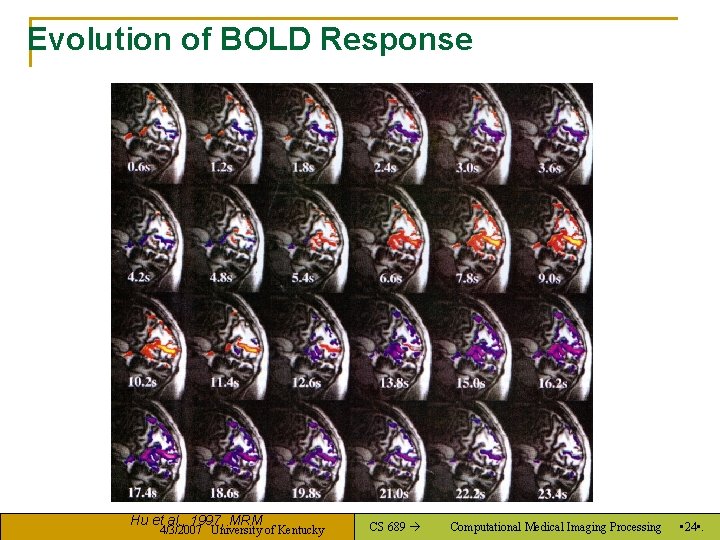 Evolution of BOLD Response Hu et al. , 1997, MRM 4/3/2007 University of Kentucky