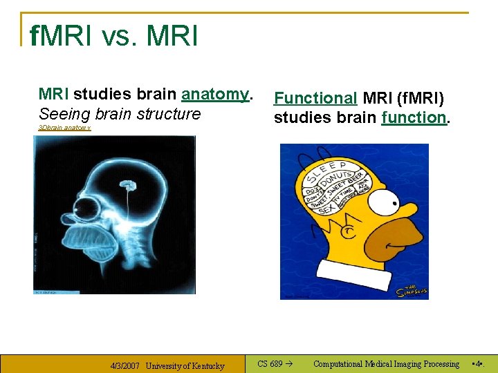 f. MRI vs. MRI studies brain anatomy. Seeing brain structure 3 Dbrain anatomy 4/3/2007