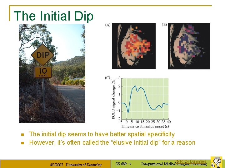 The Initial Dip n n The initial dip seems to have better spatial specificity