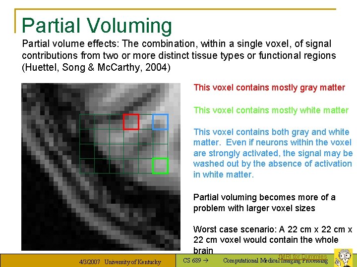 Partial Voluming Partial volume effects: The combination, within a single voxel, of signal contributions