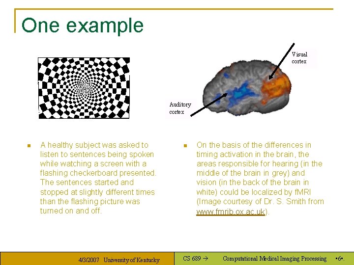 One example Visual cortex Auditory cortex n A healthy subject was asked to listen