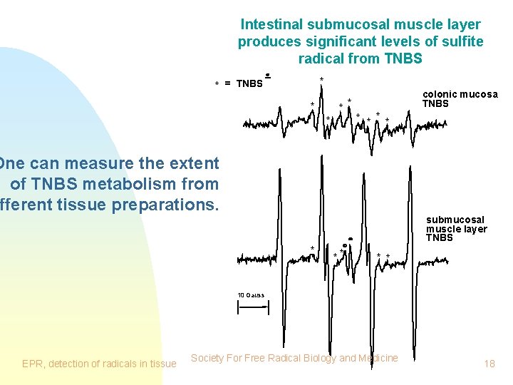 Intestinal submucosal muscle layer produces significant levels of sulfite radical from TNBS * *