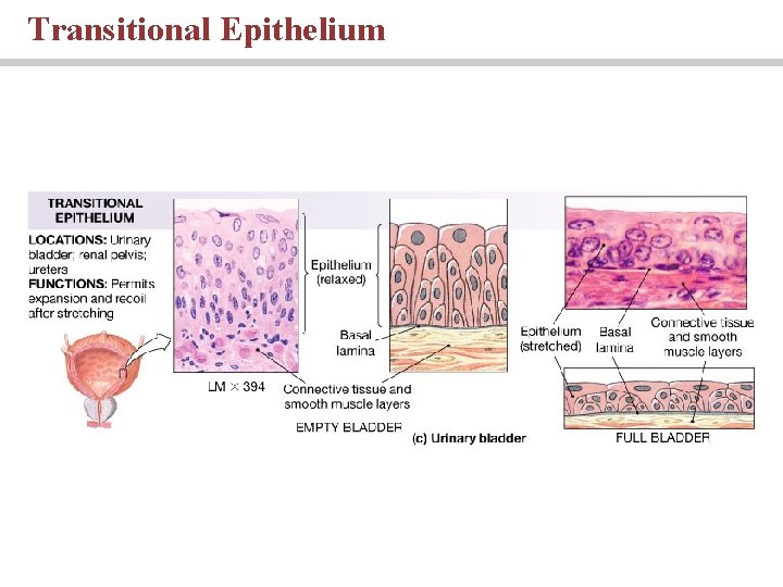 Transitional Epithelium 