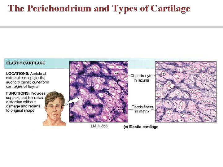 The Perichondrium and Types of Cartilage 