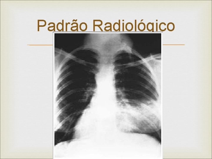 Padrão Radiológico Padrão Radiológico