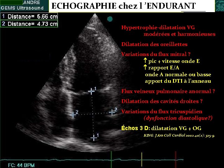 ECHOGRAPHIE chez l ’ENDURANT Hypertrophie-dilatation VG modérées et harmonieuses Dilatation des oreillettes Variations du