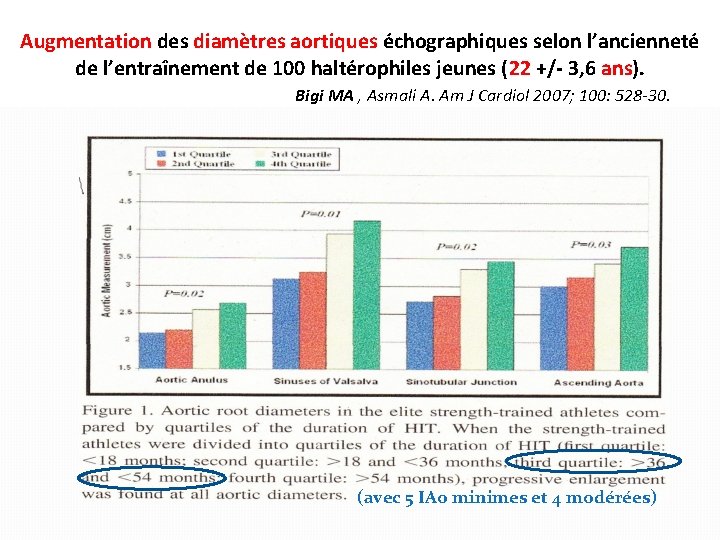 Augmentation des diamètres aortiques échographiques selon l’ancienneté de l’entraînement de 100 haltérophiles jeunes (22