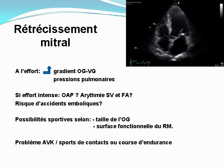 Rétrécissement mitral A l’effort: gradient OG-VG pressions pulmonaires Si effort intense: OAP ? Arythmie