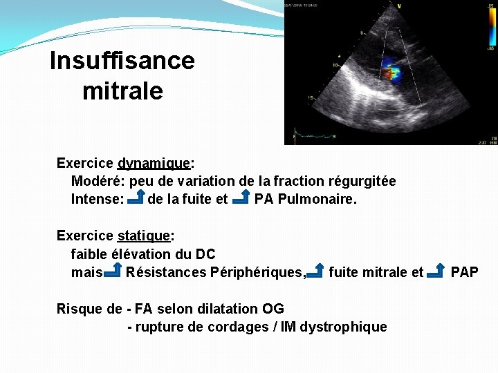 Insuffisance mitrale Exercice dynamique: Modéré: peu de variation de la fraction régurgitée Intense: de