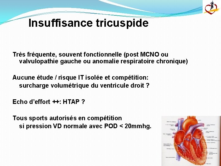 Insuffisance tricuspide Très fréquente, souvent fonctionnelle (post MCNO ou valvulopathie gauche ou anomalie respiratoire