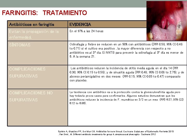 FARINGITIS: TRATAMIENTO Antibióticos en faringitis EVIDENCIA Evitan la propagación de la enfermedad. En el