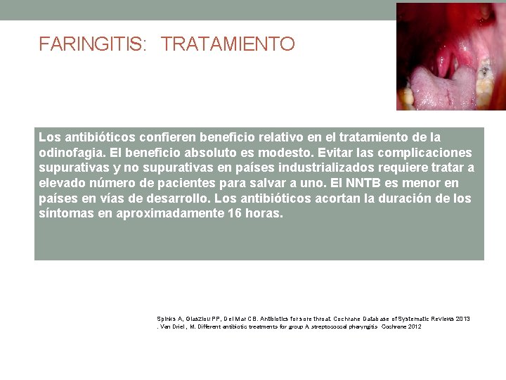 FARINGITIS: TRATAMIENTO Los antibióticos confieren beneficio relativo en el tratamiento de la odinofagia. El