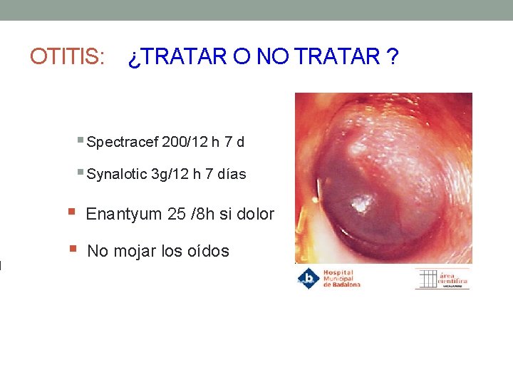 OTITIS: ¿TRATAR O NO TRATAR ? § Spectracef 200/12 h 7 d § Synalotic