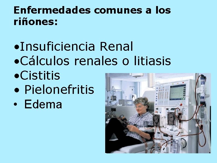 Enfermedades comunes a los riñones: • Insuficiencia Renal • Cálculos renales o litiasis •