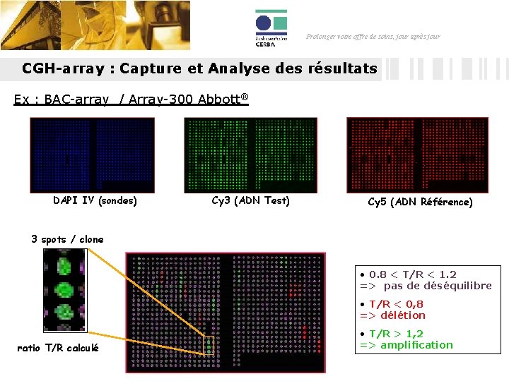 Prolonger votre offre de soins, jour après jour CGH-array : Capture et Analyse des