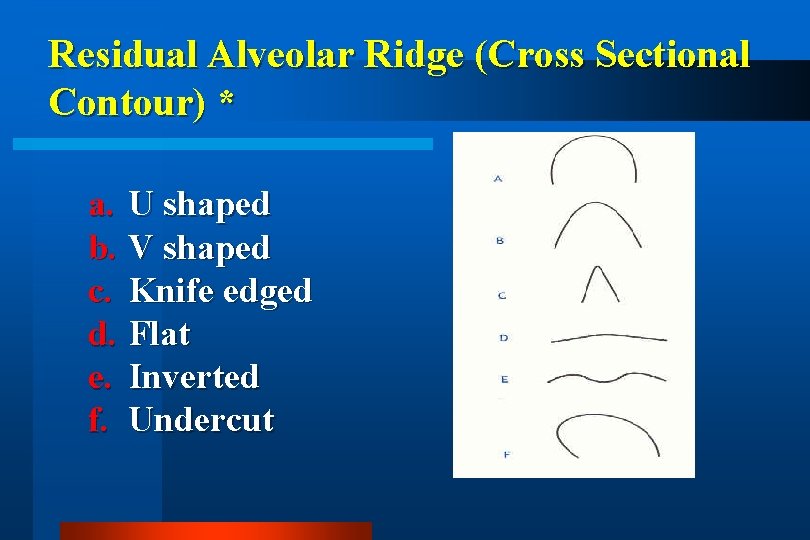 Residual Alveolar Ridge (Cross Sectional Contour) * a. U shaped b. V shaped c.