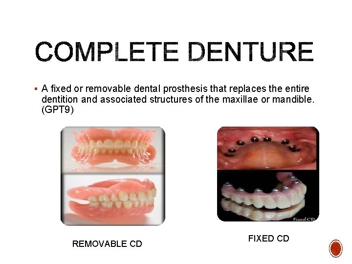 § A ﬁxed or removable dental prosthesis that replaces the entire dentition and associated