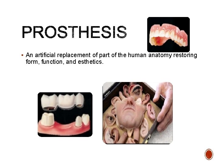 § An artiﬁcial replacement of part of the human anatomy restoring form, function, and