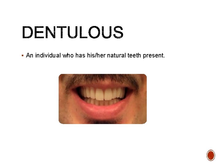 § An individual who has his/her natural teeth present. 