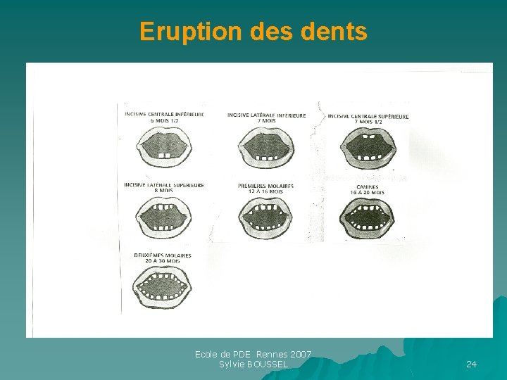 Eruption des dents Ecole de PDE Rennes 2007 Sylvie BOUSSEL 24 Eruption des dents Ecole de PDE Rennes 2007 Sylvie BOUSSEL 24