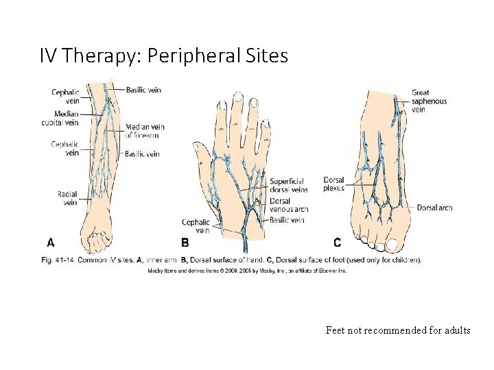 IV Therapy: Peripheral Sites Feet not recommended for adults 