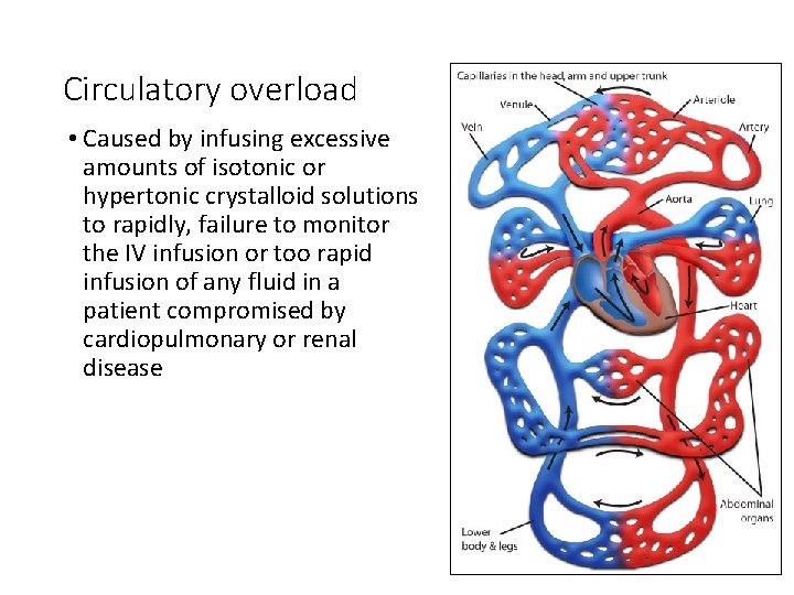 Circulatory overload • Caused by infusing excessive amounts of isotonic or hypertonic crystalloid solutions
