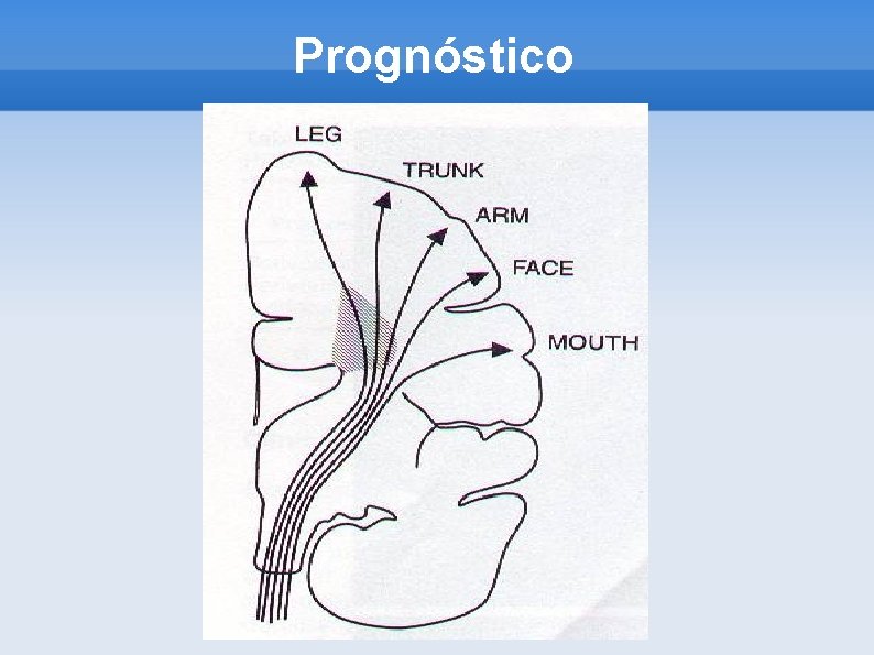 Prognóstico 