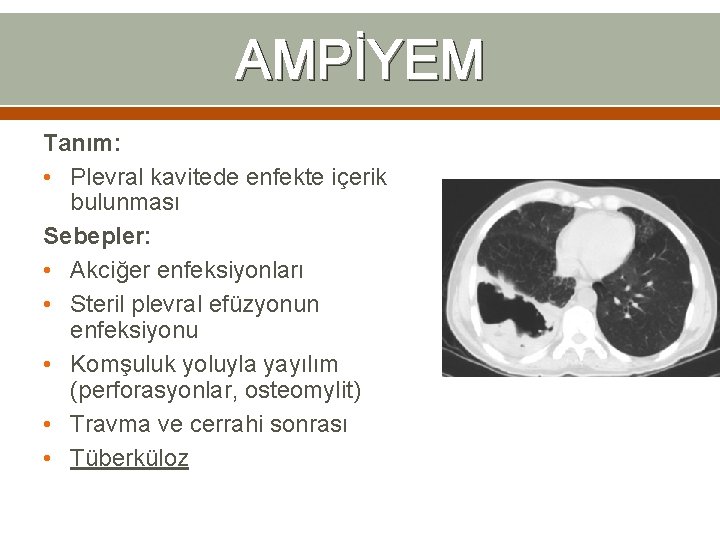 AMPİYEM Tanım: • Plevral kavitede enfekte içerik bulunması Sebepler: • Akciğer enfeksiyonları • Steril AMPİYEM Tanım: • Plevral kavitede enfekte içerik bulunması Sebepler: • Akciğer enfeksiyonları • Steril