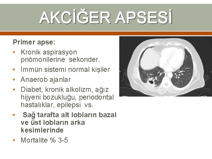 AKCİĞER APSESİ Primer apse: • Kronik aspirasyon pnömonilerine sekonder. • İmmün sistemi normal kişiler AKCİĞER APSESİ Primer apse: • Kronik aspirasyon pnömonilerine sekonder. • İmmün sistemi normal kişiler
