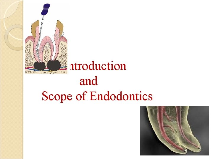 Introduction and Scope of Endodontics 