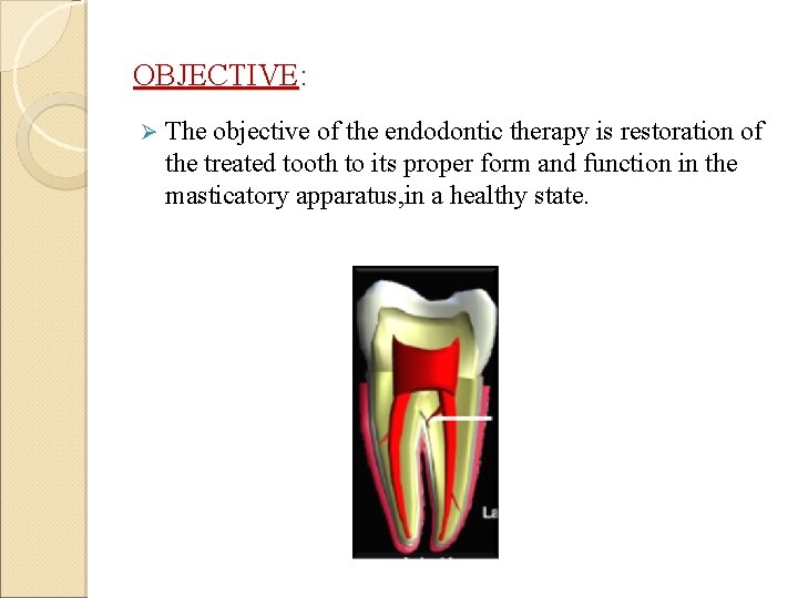 OBJECTIVE: Ø The objective of the endodontic therapy is restoration of the treated tooth
