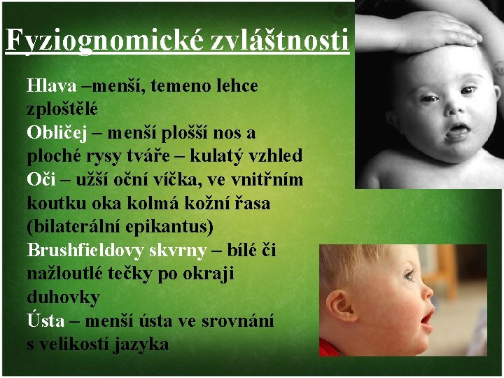 Fyziognomické zvláštnosti Hlava –menší, temeno lehce zploštělé Obličej – menší plošší nos a ploché