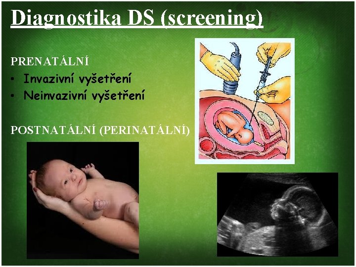 Diagnostika DS (screening) PRENATÁLNÍ • Invazivní vyšetření • Neinvazivní vyšetření POSTNATÁLNÍ (PERINATÁLNÍ) 