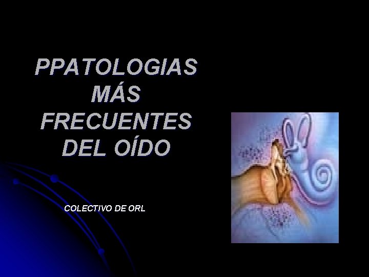 PPATOLOGIAS MÁS FRECUENTES DEL OÍDO COLECTIVO DE ORL PPATOLOGIAS MÁS FRECUENTES DEL OÍDO COLECTIVO DE ORL