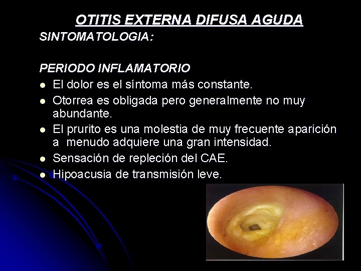 OTITIS EXTERNA DIFUSA AGUDA SINTOMATOLOGIA: PERIODO INFLAMATORIO l El dolor es el síntoma más OTITIS EXTERNA DIFUSA AGUDA SINTOMATOLOGIA: PERIODO INFLAMATORIO l El dolor es el síntoma más