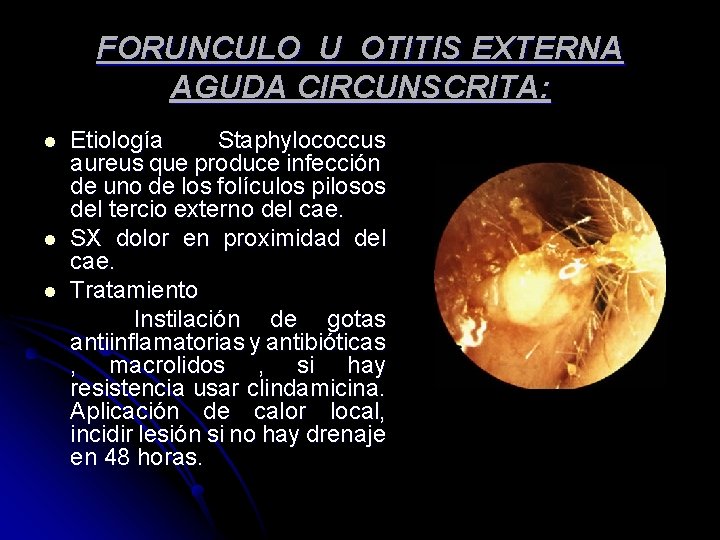FORUNCULO U OTITIS EXTERNA AGUDA CIRCUNSCRITA: Etiología Staphylococcus aureus que produce infección de uno FORUNCULO U OTITIS EXTERNA AGUDA CIRCUNSCRITA: Etiología Staphylococcus aureus que produce infección de uno