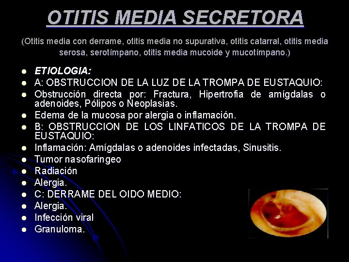 OTITIS MEDIA SECRETORA (Otitis media con derrame, otitis media no supurativa, otitis catarral, otitis OTITIS MEDIA SECRETORA (Otitis media con derrame, otitis media no supurativa, otitis catarral, otitis