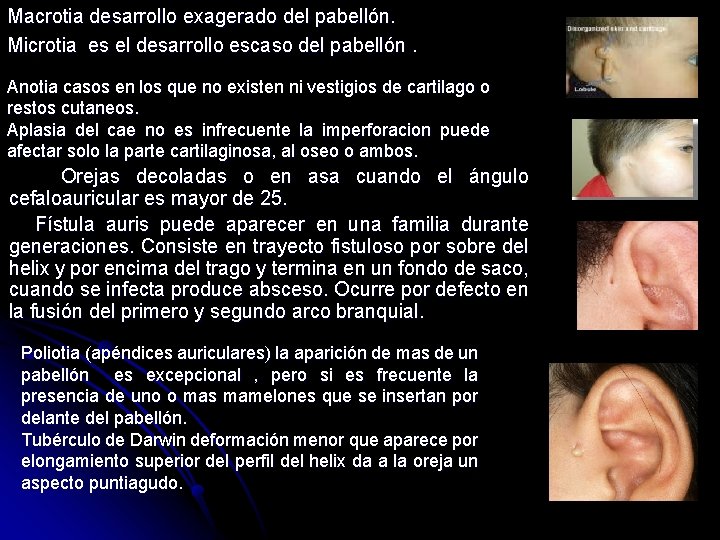 Macrotia desarrollo exagerado del pabellón. Microtia es el desarrollo escaso del pabellón. Anotia casos Macrotia desarrollo exagerado del pabellón. Microtia es el desarrollo escaso del pabellón. Anotia casos