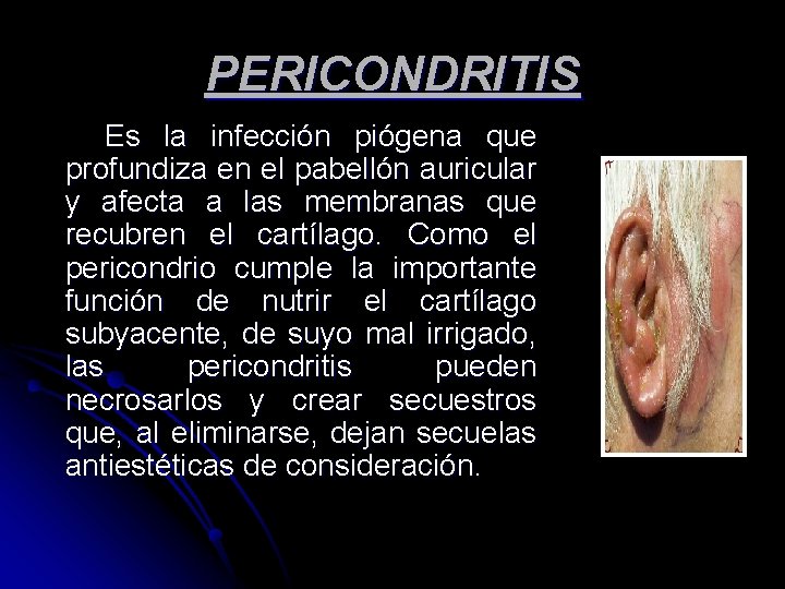 PERICONDRITIS Es la infección piógena que profundiza en el pabellón auricular y afecta a PERICONDRITIS Es la infección piógena que profundiza en el pabellón auricular y afecta a